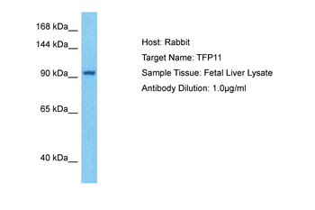 TFIP11 Rabbit Polyclonal Antibody