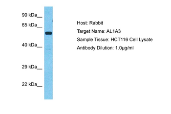 ALDH1A3 Rabbit Polyclonal Antibody