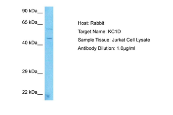 CSNK1D Rabbit Polyclonal Antibody