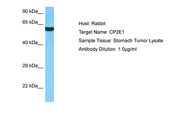 CYP2E1 Rabbit Polyclonal Antibody