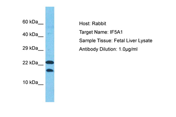 EIF5A Rabbit Polyclonal Antibody