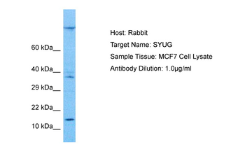 SNCG Rabbit Polyclonal Antibody