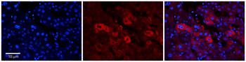 EEA1 Rabbit Polyclonal Antibody