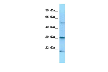 BAK1 Rabbit Polyclonal Antibody