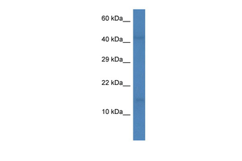 CCL16 Rabbit Polyclonal Antibody