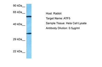 ATF5 Rabbit Polyclonal Antibody