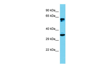 ATF5 Rabbit Polyclonal Antibody