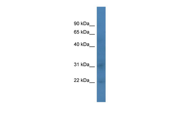 Taf12 Rabbit Polyclonal Antibody