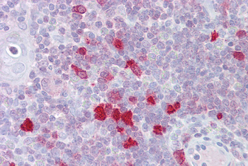 DLX5 Rabbit Polyclonal Antibody