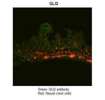 GLI2 Rabbit Polyclonal Antibody