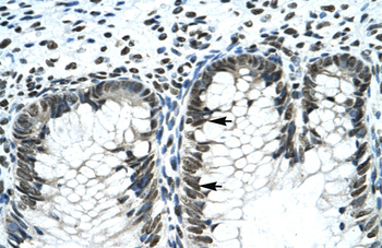 GLI2 Rabbit Polyclonal Antibody