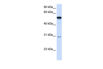 AIRE Rabbit Polyclonal Antibody