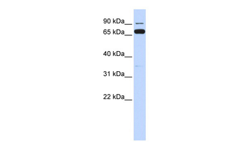 IKBKB Rabbit Polyclonal Antibody