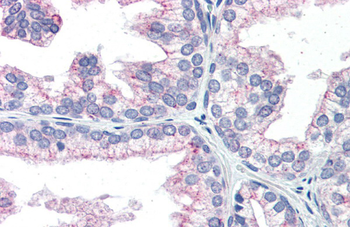 NAB1 Rabbit Polyclonal Antibody