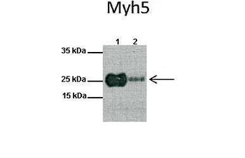MYF5 Rabbit Polyclonal Antibody