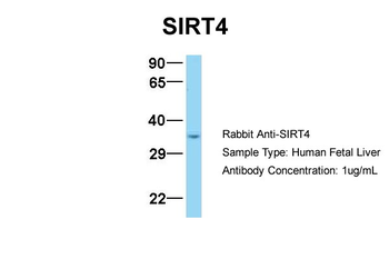SIRT4 Rabbit Polyclonal Antibody