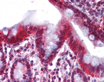 HNF4A Rabbit Polyclonal Antibody