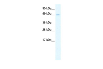 AIRE Rabbit Polyclonal Antibody