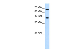 NR4A2 Rabbit Polyclonal Antibody