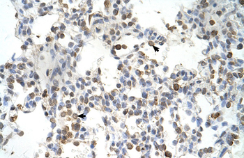DLX5 Rabbit Polyclonal Antibody