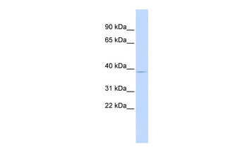 PITX3 Rabbit Polyclonal Antibody