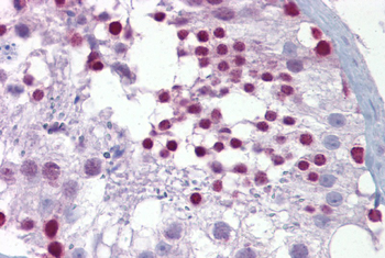 PITX3 Rabbit Polyclonal Antibody
