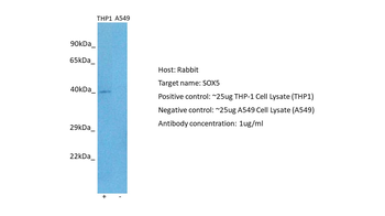 SOX5 Rabbit Polyclonal Antibody