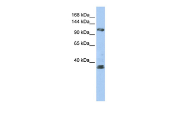 ZEB2 Rabbit Polyclonal Antibody