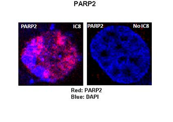 PARP2 Rabbit Polyclonal Antibody