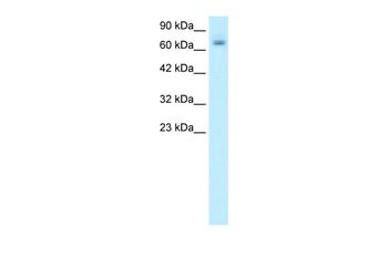PARP2 Rabbit Polyclonal Antibody