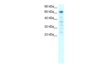 PARP3 Rabbit Polyclonal Antibody