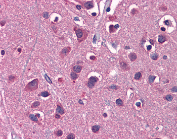 SLC1A2 Rabbit Polyclonal Antibody