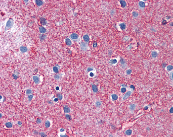 SLC1A2 Rabbit Polyclonal Antibody
