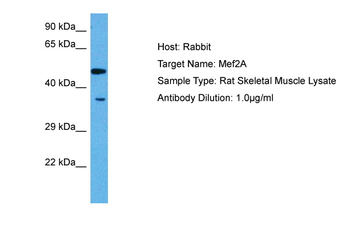 MEF2A Rabbit Polyclonal Antibody
