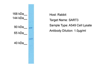SART3 Rabbit Polyclonal Antibody
