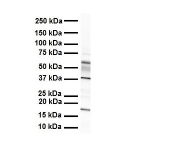 ZYX Rabbit Polyclonal Antibody
