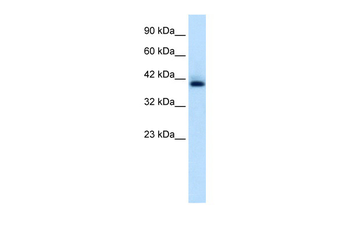 HEXIM1 Rabbit Polyclonal Antibody