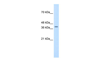 TFB2M Rabbit Polyclonal Antibody