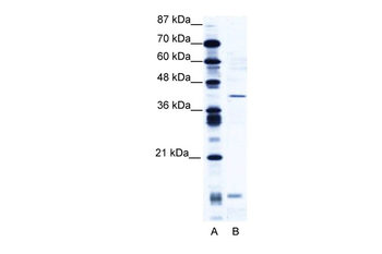 CREM Rabbit Polyclonal Antibody
