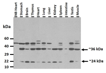 Crem Rabbit Polyclonal Antibody