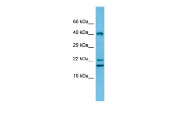 Crem Rabbit Polyclonal Antibody