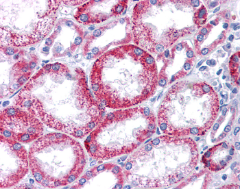 KCNQ1 Rabbit Polyclonal Antibody