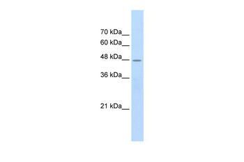 CHRNB2 Rabbit Polyclonal Antibody