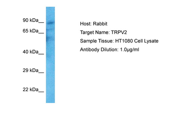 TRPV2 Rabbit Polyclonal Antibody