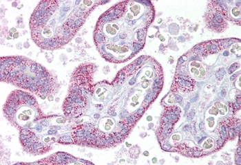 TRPC4 Rabbit Polyclonal Antibody