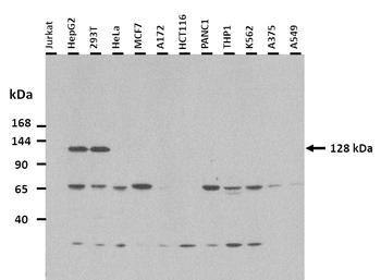 TRPM8 Rabbit Polyclonal Antibody