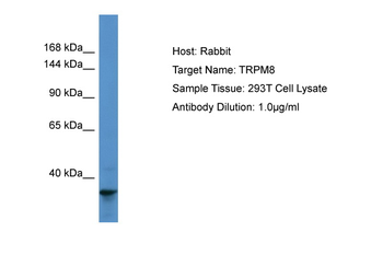 TRPM8 Rabbit Polyclonal Antibody