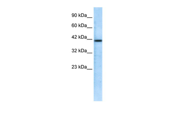 CHRFAM7A Rabbit Polyclonal Antibody