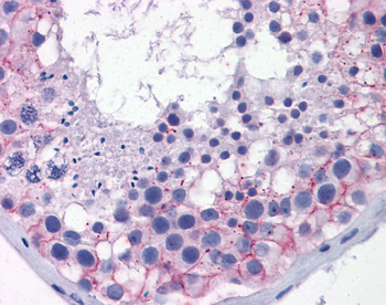 TJP1 Rabbit Polyclonal Antibody
