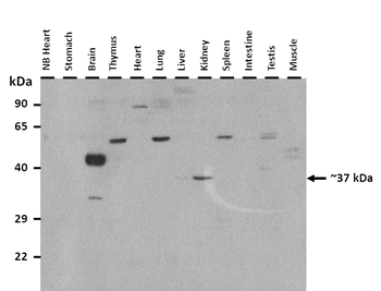 Etv2 Rabbit Polyclonal Antibody